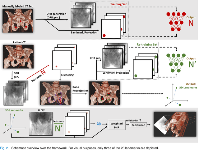 Figure 2 for Pose-dependent weights and Domain Randomization for fully automatic X-ray to CT Registration