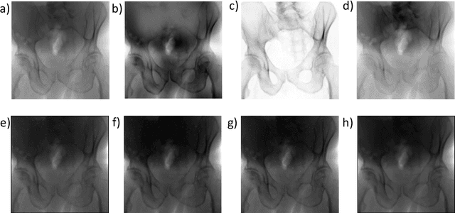 Figure 4 for Pose-dependent weights and Domain Randomization for fully automatic X-ray to CT Registration