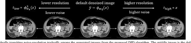 Figure 2 for Deep Interactive Denoiser  for X-Ray Computed Tomography