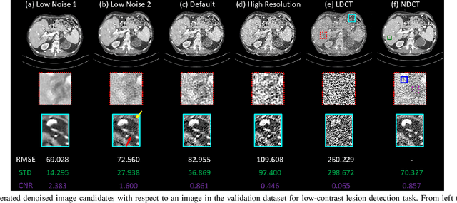 Figure 3 for Deep Interactive Denoiser (DID) for X-Ray Computed Tomography