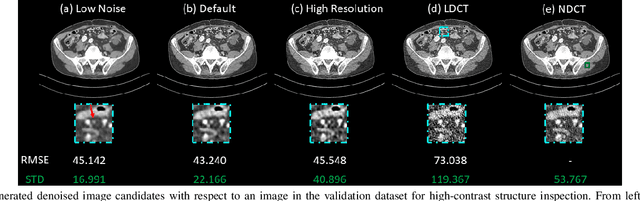 Figure 4 for Deep Interactive Denoiser  for X-Ray Computed Tomography