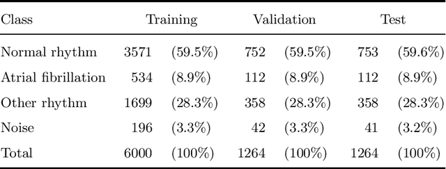 Figure 1 for Cardiac Arrhythmia Detection from ECG with Convolutional Recurrent Neural Networks