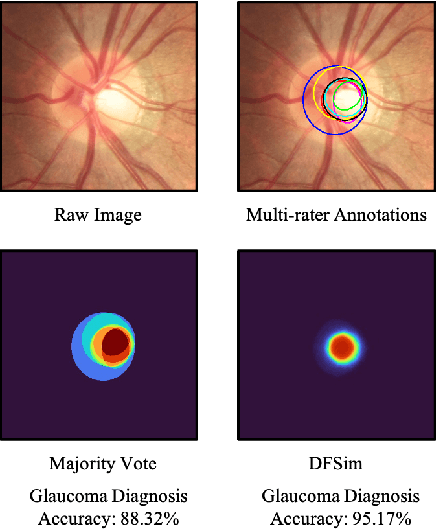 Figure 1 for Opinions Vary? Diagnosis First!