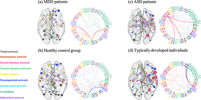 Figure 4 for BrainIB: Interpretable Brain Network-based Psychiatric Diagnosis with Graph Information Bottleneck
