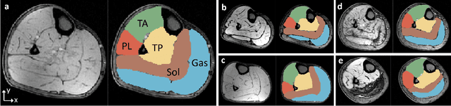 Figure 1 for FilterNet: A Neighborhood Relationship Enhanced Fully Convolutional Network for Calf Muscle Compartment Segmentation