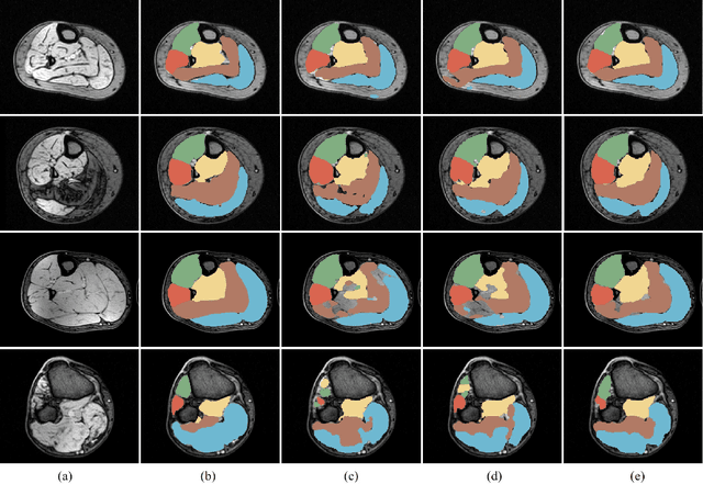 Figure 4 for FilterNet: A Neighborhood Relationship Enhanced Fully Convolutional Network for Calf Muscle Compartment Segmentation