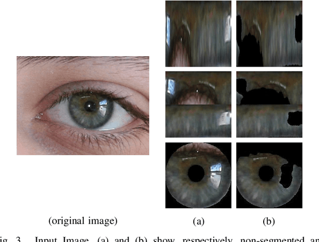 Figure 3 for The Impact of Preprocessing on Deep Representations for Iris Recognition on Unconstrained Environments