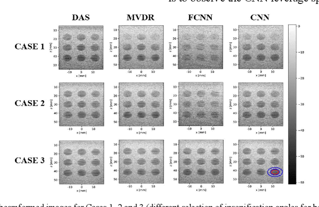 Figure 2 for Towards Fast Region Adaptive Ultrasound Beamformer for Plane Wave Imaging Using Convolutional Neural Networks