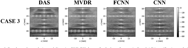 Figure 3 for Towards Fast Region Adaptive Ultrasound Beamformer for Plane Wave Imaging Using Convolutional Neural Networks