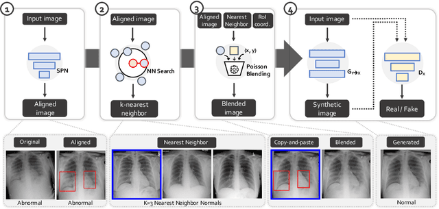 Figure 3 for Generative Residual Attention Network for Disease Detection