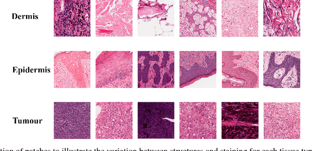 Figure 1 for Fully Convolutional Network for Melanoma Diagnostics