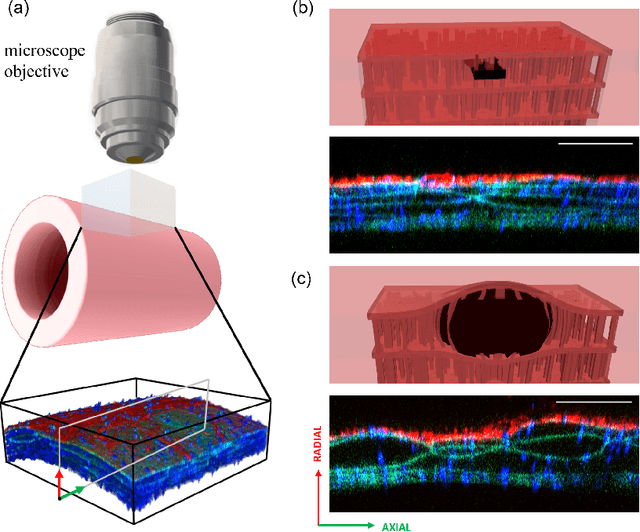 Figure 3 for Simulating progressive intramural damage leading to aortic dissection using an operator-regression neural network