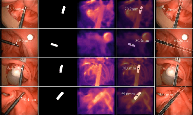 Figure 4 for Data-driven Holistic Framework for Automated Laparoscope Optimal View Control with Learning-based Depth Perception