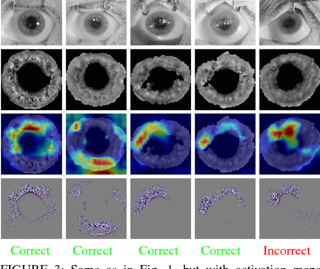 Figure 3 for DCNN-based Human-Interpretable Post-mortem Iris Recognition