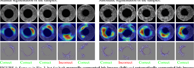 Figure 4 for DCNN-based Human-Interpretable Post-mortem Iris Recognition