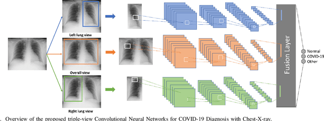 Figure 1 for Triple-view Convolutional Neural Networks for COVID-19 Diagnosis with Chest X-ray