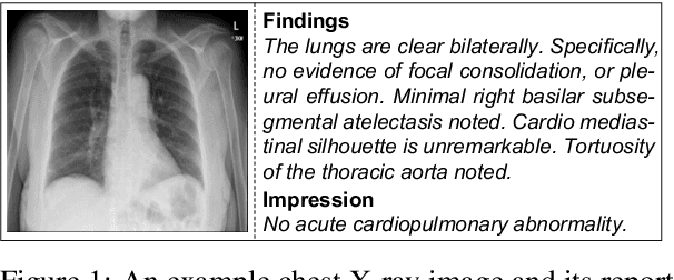 Figure 1 for Generating Radiology Reports via Memory-driven Transformer