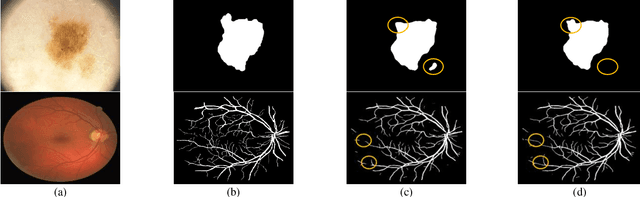 Figure 2 for Iterative Deep Convolutional Encoder-Decoder Network for Medical Image Segmentation