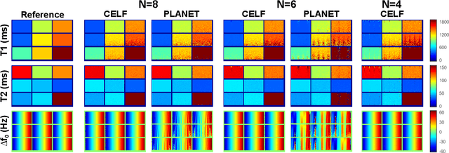 Figure 4 for Constrained Ellipse Fitting for Efficient Parameter Mapping with Phase-cycled bSSFP MRI