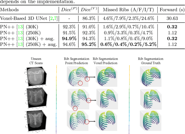 Figure 4 for RibSeg Dataset and Strong Point Cloud Baselines for Rib Segmentation from CT Scans