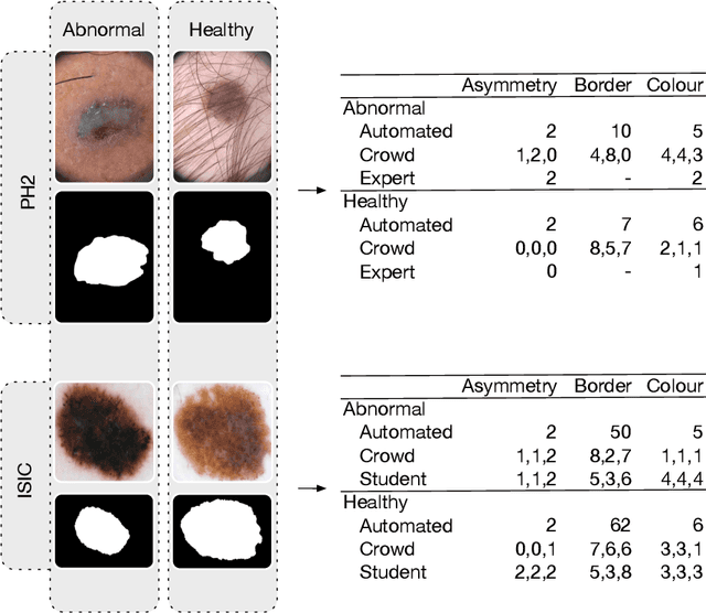 Figure 2 for ENHANCE (ENriching Health data by ANnotations of Crowd and Experts): A case study for skin lesion classification