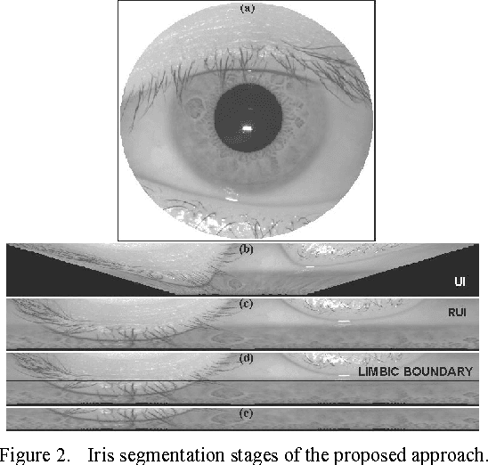 Figure 3 for Exploring New Directions in Iris Recognition