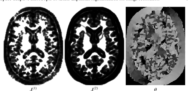 Figure 4 for Space-adaptive anisotropic bivariate Laplacian regularization for image restoration