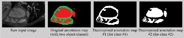 Figure 1 for Decompose-and-Integrate Learning for Multi-class Segmentation in Medical Images