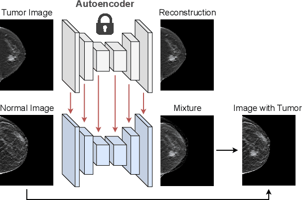 Figure 3 for REPLICA: Enhanced Feature Pyramid Network by Local Image Translation and Conjunct Attention for High-Resolution Breast Tumor Detection
