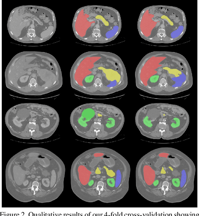 Figure 4 for Efficient Multi-Organ Segmentation Using SpatialConfiguration-Net with Low GPU Memory Requirements