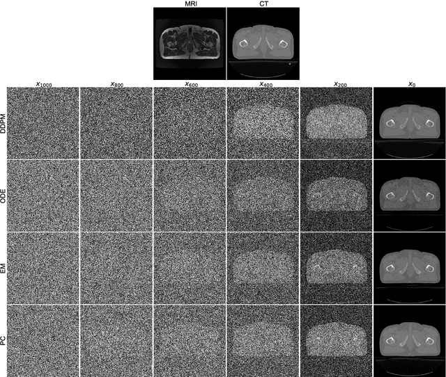 Figure 2 for Conversion Between CT and MRI Images Using Diffusion and Score-Matching Models