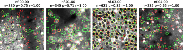 Figure 1 for Fast, Simple Calcium Imaging Segmentation with Fully Convolutional Networks