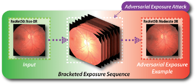 Figure 1 for Adversarial Exposure Attack on Diabetic Retinopathy Imagery