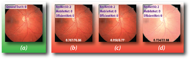 Figure 3 for Adversarial Exposure Attack on Diabetic Retinopathy Imagery