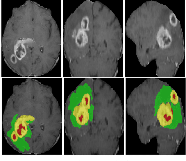 Figure 4 for Efficient embedding network for 3D brain tumor segmentation