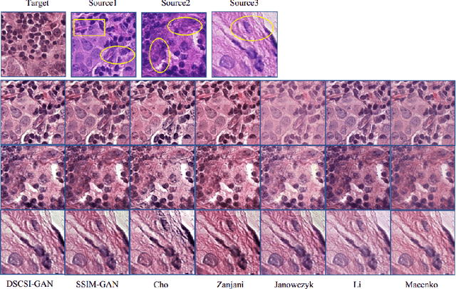 Figure 2 for Stain Style Transfer of Histopathology Images Via Structure-Preserved Generative Learning