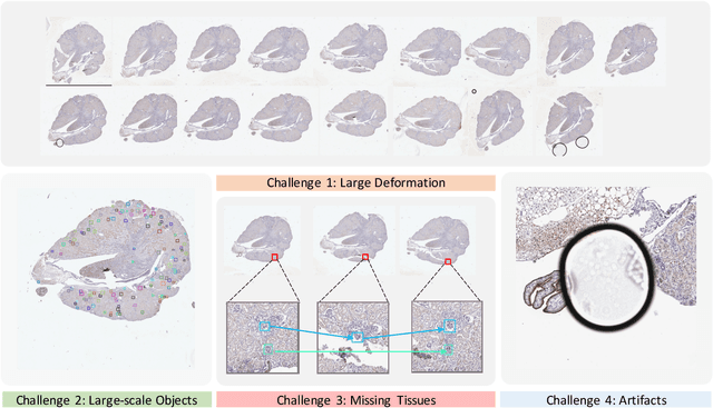 Figure 1 for Map3D: Registration Based Multi-Object Tracking on 3D Serial Whole Slide Images