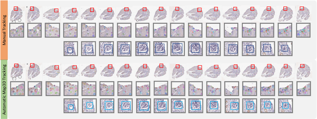 Figure 4 for Map3D: Registration Based Multi-Object Tracking on 3D Serial Whole Slide Images