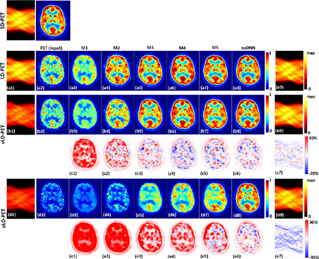 Figure 3 for Towards Lower-Dose PET using Physics-Based Uncertainty-Aware Multimodal Learning with Robustness to Out-of-Distribution Data