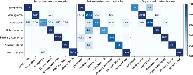Figure 4 for Contrastive Representation Learning for Rapid Intraoperative Diagnosis of Skull Base Tumors Imaged Using Stimulated Raman Histology
