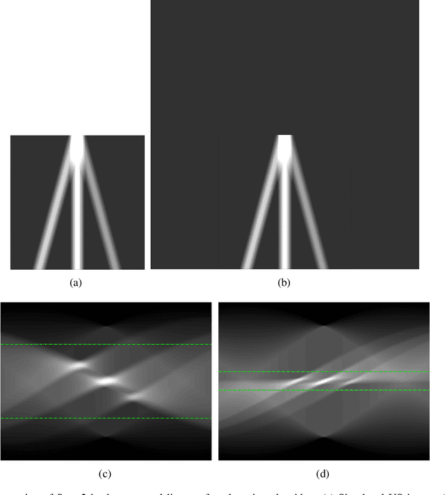 Figure 3 for Line Artefact Quantification in Lung Ultrasound Images of COVID-19 Patients via Non-Convex Regularisation