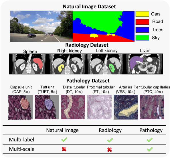Figure 1 for Omni-Seg+: A Scale-aware Dynamic Network for Pathological Image Segmentation