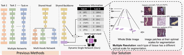 Figure 2 for Omni-Seg+: A Scale-aware Dynamic Network for Pathological Image Segmentation