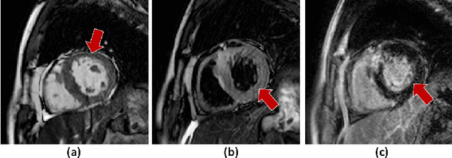 Figure 1 for Automated Multi-sequence Cardiac MRI Segmentation Using Supervised Domain Adaptation