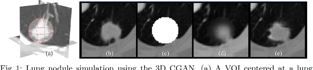 Figure 1 for CT-Realistic Lung Nodule Simulation from 3D Conditional Generative Adversarial Networks for Robust Lung Segmentation