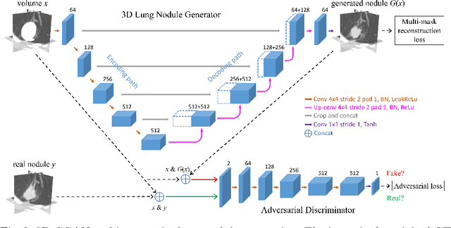 Figure 2 for CT-Realistic Lung Nodule Simulation from 3D Conditional Generative Adversarial Networks for Robust Lung Segmentation