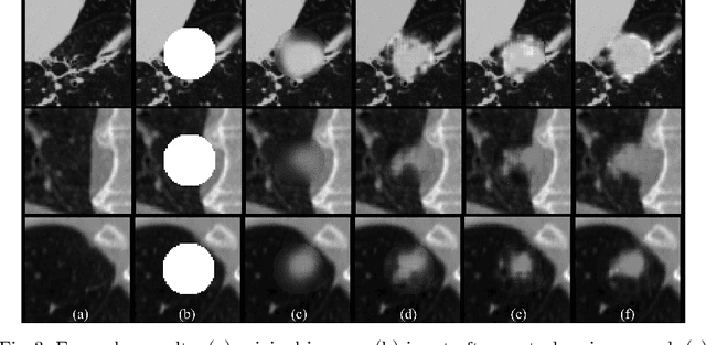 Figure 3 for CT-Realistic Lung Nodule Simulation from 3D Conditional Generative Adversarial Networks for Robust Lung Segmentation