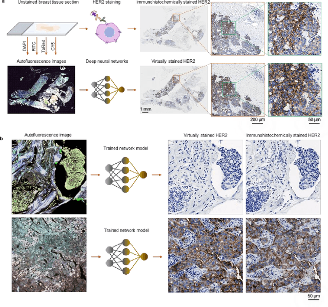 Figure 1 for Label-free virtual HER2 immunohistochemical staining of breast tissue using deep learning