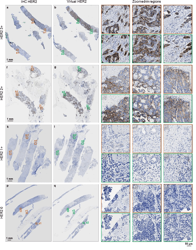 Figure 3 for Label-free virtual HER2 immunohistochemical staining of breast tissue using deep learning