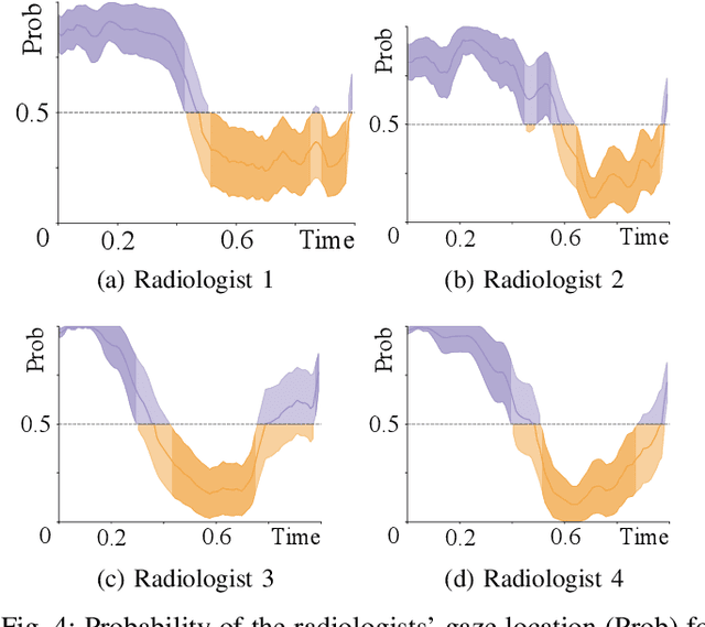 Figure 3 for Did you miss it? Automatic lung nodule detection combined with gaze information improves radiologists' screening performance
